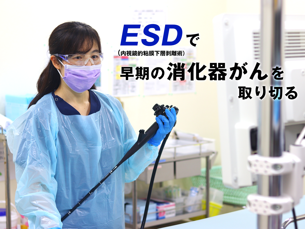 ESD（内視鏡的粘膜下層剥離術）で 早期の消化器がんを取り切る