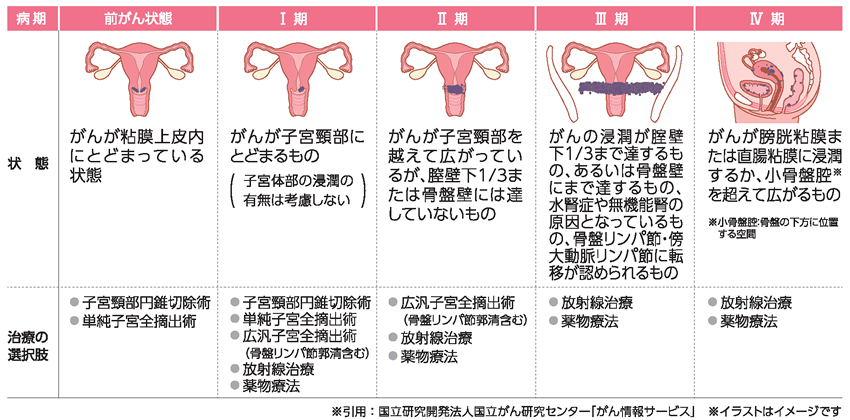 若年層にも多い子宮頸がん